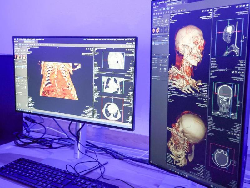 TLAXCALA CONSOLIDA AL ITAES COMO EL CENTRO PÚBLICO DE DIAGNÓSTICO MÁS AVANZADO DE LA REGIÓN